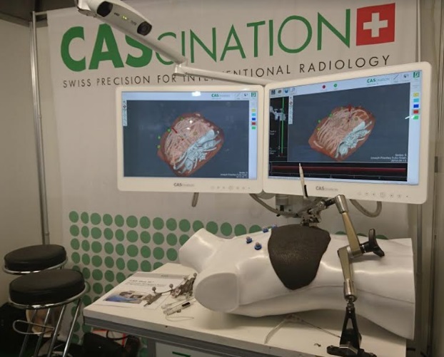 The CAS-ONE IR Stereotactic Guidance Device 