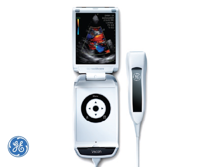 Vscan portable ultrasound