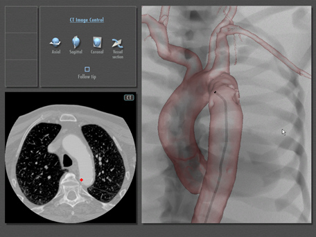 CT and MRI scan data CT and MRI scan data