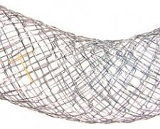 S&G Biotech EGIS Pyloric Stent | Which Medical Device