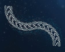 Terumo Ultimaster Coronary Stent System | Used in Coronary stenting  | Which Medical Device