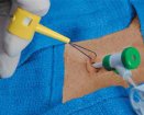 Merit Medical Systems, Inc Slip-Not Suture Retention Device | Which Medical Device