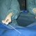 Part 1 is loaded onto the guidewire (which must already be within the artery at least 25 cms. 