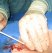 Part 1 is inserted into the artery until?