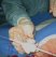 Blood spurts from the end, indicating that the device is within the artery. Part 1 is then inserted 10 ? 15 mm further into the artery. 