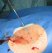The blue tamping bar is pushed downwards to compress the collagen plug onto the outside of the arterial wall and haemostatis should be complete. 