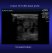 zonare-zone-neonatal-kidney.jpg