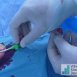 terumo-radial-sheath-thumb.jpg