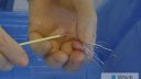 IVC Filter Insertion