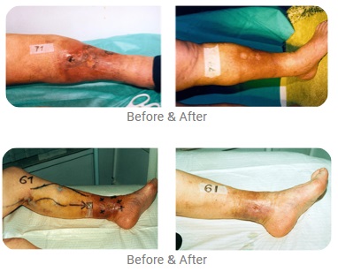 Before and after images