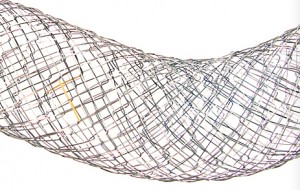 Pyloric Stent