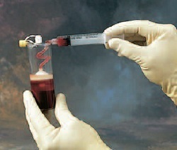 Biomet Gravitational Platelet Separation System