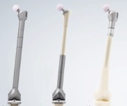 The Megasystem-C Endoprosthetic Replacement System from LINK