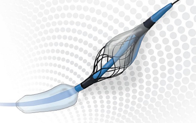 The Paladin from Contego Medical