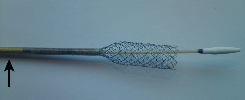 Figure 3: Biliary delivery system (Egis single bare). Note the wire braiding in the delivery sheath (arrow).