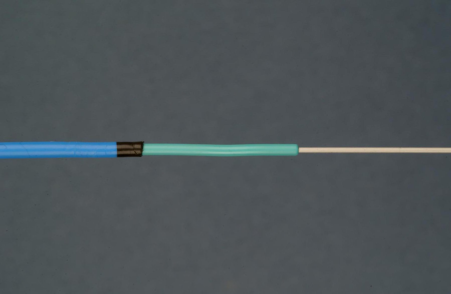 The co-axial system with an inner 5F ureteric catheter and an outer 9F introducer sheath over a guide-wire.