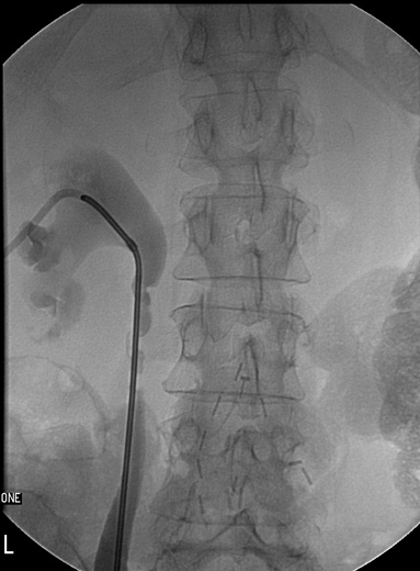The proximal end
