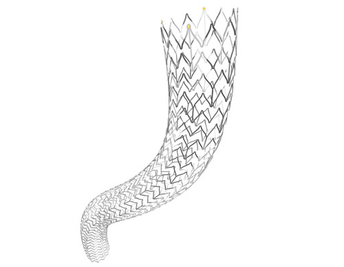 Zilver Stent