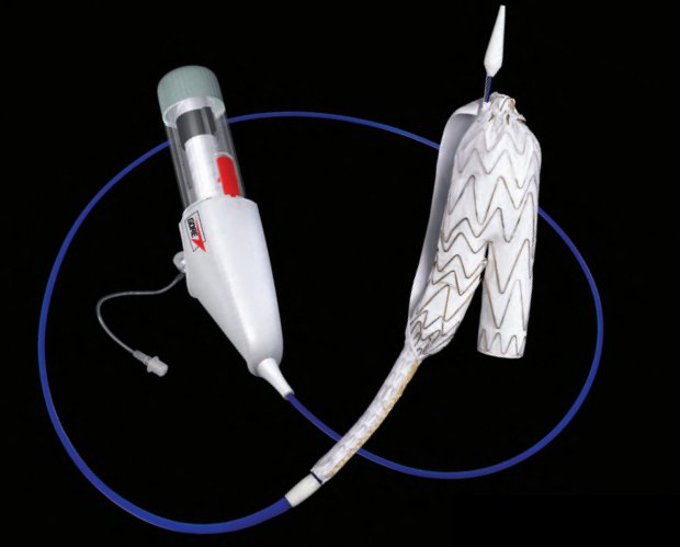 Gore EXCLUDER AAA Endoprosthesis