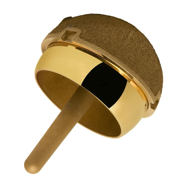 ACCIS Resurfacing Hip System