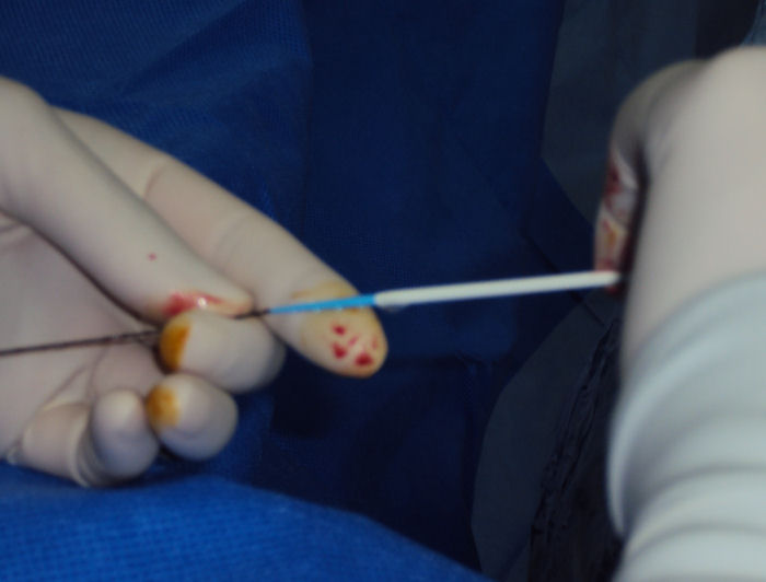 Sheath onto wire