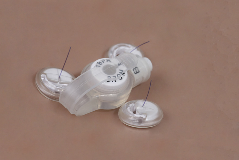 Vygon MIC Introducer Kit