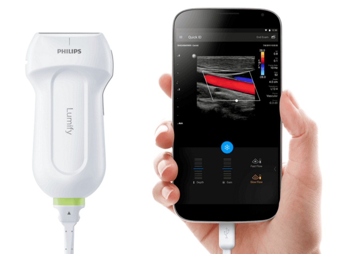 Lumify ultrasound system