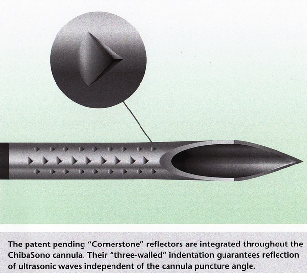 Editorial | Which Medical Device Discusses Some of the Products on Show ...