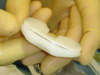 Stryker X3 Highly Crosslinked Polyethylene Tibial Tray