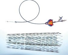 Invatec Cristallo Ideale | Used in Carotid stenting  | Which Medical Device