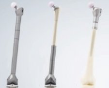 LINK Megasystem-C Endoprosthetic Replacement System | Used in Proximal femoral resection  | Which Medical Device