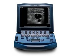 SonoSite M-Turbo Ultrasound Machine | Used in Regional anaesthesia, Ultrasound guidance, Venous access  | Which Medical Device