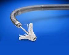 Abbott Vascular MitraClip Mitral Valve Repair System | Used in Mitral valve repair | Which Medical Device