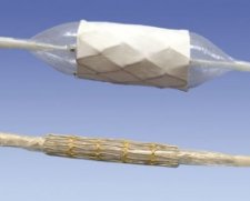 NuMED Mounted CP Stent | Which Medical Device