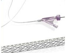 Abbott Vascular Xpert Self-Expanding Stent System | Used in Angioplasty, Infrapopliteal arterial disease management | Which Medical Device