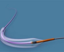 Abbott Vascular Trek Balloon | Which Medical Device
