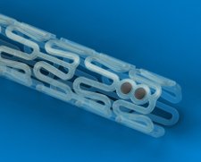 Abbott Vascular ABSORB Bioresorbable Vascular Scaffold | Used in Coronary stenting, CTO Recanalisation | Which Medical Device