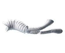 Lombard Medical Aorfix AAA Stent Graft System | Used in Endovascular aneurysm repair (EVAR), Vascular stenting  | Which Medical Device