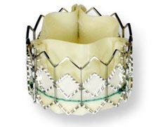 Edwards Life Sciences SAPIEN Transcatheter Heart Valve  | Used in Transcatheter aortic valve implantation (TAVI) | Which Medical Device