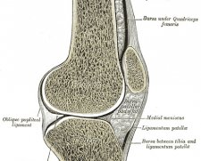 Depuy Mitek Cartilage Autograft Implantation System (CAIS) | Used in Articular cartilage repair  | Which Medical Device