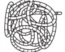 Penumbra Ruby Coil Embolization System | Used in Aneurysm coiling, Aneurysm occlusion, Embolisation | Which Medical Device