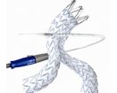 Medtronic Endurant AAA Stent Graft  | Used in Endovascular aneurysm repair (EVAR), Vascular stenting | Which Medical Device