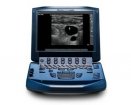 SonoSite M-Turbo Ultrasound Machine | Used in Regional anaesthesia, Ultrasound guidance, Venous access | Which Medical Device