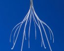 Cook Medical Celect Vena Cava Filter | Used in IVC filter | Which Medical Device