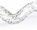 Orbus Neich R Stent | Which Medical Device