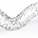 orbus-r-stent.jpg