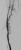 post 6mm angioplasty