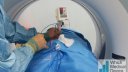 Renal tumour RF ablation with Covidien Cooltip